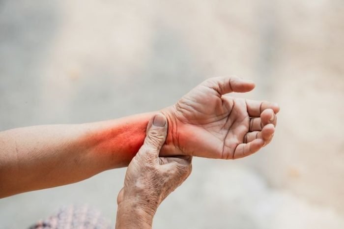 Joint Pain & Arthritis